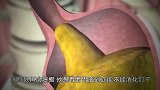 测试人体胃液能否消化钉子，结果出乎意料