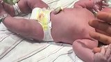 小婴儿刚剪完脐带还新鲜着，哭到嘴唇发颤，真惹人怜爱！