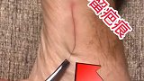 想不到医学竟然都这么先进了