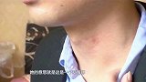 男子脖子上出现“吻痕”？！女友一怒之下要分手！男子：我这是睡出来的啊 吻痕