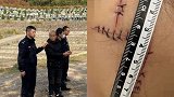 男子求复合不成便怀疑女友出轨 在女方脸上连划三刀