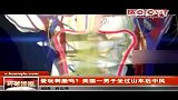 爱玩刺激吗？美国一男子坐过山车后中风