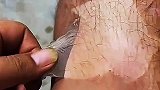 还可以这么撕啊，皮肤碎片
