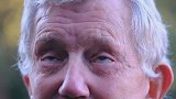 英国一79岁老人整容手术失败 导致左眼三年无法闭上