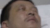 湖南长沙：烟花不响男子心急查看 “冲天炮”直接冲进右眼