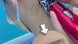 原来头发还可以用来种眉毛