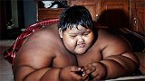 世界上最胖的少年：每天要吃5顿饭，11岁体重就有400斤！