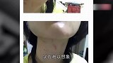 又一年轻偶像疑家暴，女方现18处伤痕，掰断手指剪光头发太可怕
