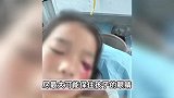 8岁女孩被钢珠射中左眼失明后续：男孩家属答应垫付10万医药费又反悔