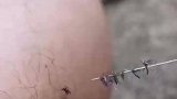 网友花样抓蚊子，这操作是个狠人