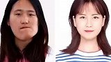 歪脸女孩蜕变后，不愿成为网红只想成为一名教师