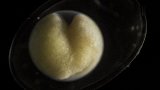 受精卵成长全记录！看生命诞生之美：见证破壳的奇迹