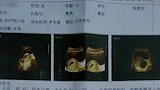 被害反遭打！遭遇多人猥亵的智障女孩：被指认者上门打我