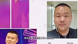 德云社相声：当主持人问到岳云鹏整容事件小岳岳逐渐没了笑容
