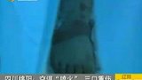 空调“喷火” 一家三口烧成重伤-8月2日