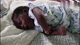 刚出生的黑人萌宝患有先天性癫痫，希望可怜的萌宝能尽快痊愈