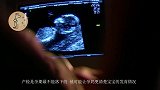 孕期“闯过”三大产检难关，说明胎儿发育健康，孕妈可以松口气了