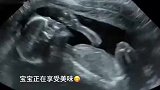 婴儿在妈妈肚中趣事，你以为妈妈开怀大笑，婴儿以为在地震呢