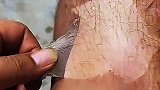 还可以这么撕啊，皮肤碎片