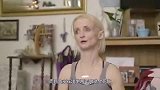美国女子患罕见怪病，年纪轻轻却长相苍老如同老人，被剥夺了青春