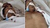 印度一男子在被宣布死亡7小时后醒来