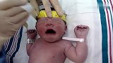 宝宝刚刚出生的时候，张嘴大哭不止，爸妈看着医生不淡定了
