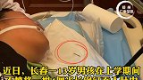 4厘米钢钉含嘴里玩，13岁男孩不慎误吞！钢钉