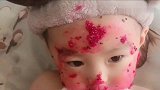 妈妈不在家，爸爸让一岁的女儿自己吃火龙果，结局悲催了