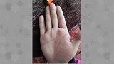 口子纹听说过吗？它长在这里，婚姻有名无实！