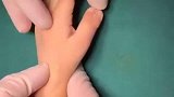 出生就与众不同，因为孩子这双手，父母愁得睡不着觉！