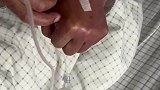 大爷医院输液，见护士没扎上针自己上手