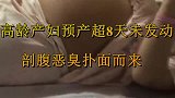 高龄孕妇预产期超8天未发动，医生紧急剖腹，结果吓坏了众人！