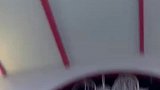 小姐姐不畏脸上胎记大方展现自己的美