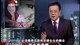 怀旧影视-20230310-传奇-火炉离奇爆炸，全家只剩孕妇活命！浑身烧伤医生看了都摇头