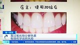 “7天能变白” 网红美白牙贴靠谱吗？