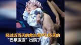 胎龄25周女婴奇迹存活出院：出生仅480克身长20厘米