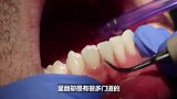 蛀牙真的是被“虫子”吃光的吗？看完3D视频演示，你受得了吗？