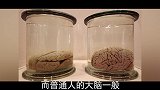 爱因斯坦是世界上最聪明的人，他的大脑却比一般人还小？