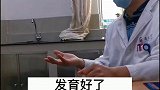 小孩骨折 ，如果家长不当一回事，后果很麻烦医学科普 健康