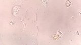 显微镜下的红牛 显微镜  红牛
