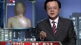 传奇：医生为少女换脸，从被人嫌弃到光彩照人，堪称最强整容术