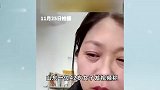 短短20天，女子“断崖式衰老”！医生：无法逆转