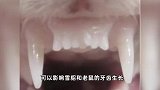 日本团队研发“长牙”新药，计划今年9月开始人体试验