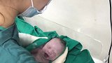 刚剖出来的宝宝是什么样子的实拍产房内宝宝出生的一幕
