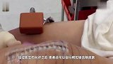 美国发明新型“拉链”,贴近伤口一拉就愈合,彻底颠覆传统医疗