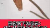显微镜下世界的一大奇迹！单细胞生物被吃掉一半，竟然还能活下来