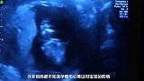孕期妈妈伤心落泪时，胎儿是什么样的感受？看完才懂得母子连心