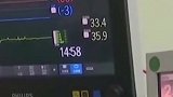 中国人工心脏再次领先世界