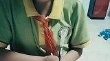 令人敬佩的小女孩，坚强又乐观