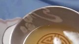 男子高烧面红耳赤，妻子端来药汤服侍，看到最后男子多少是有些无奈